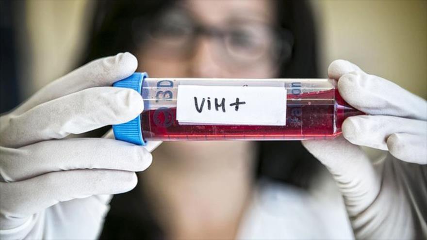 ¡ESPERANZAS! Presentan nuevos avances hacia una vacuna eficaz frente al VIH